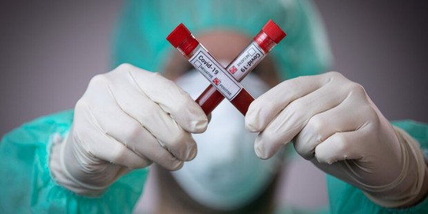 В Одесской области за сутки выявили 34 новых случая коронавирусной инфекции